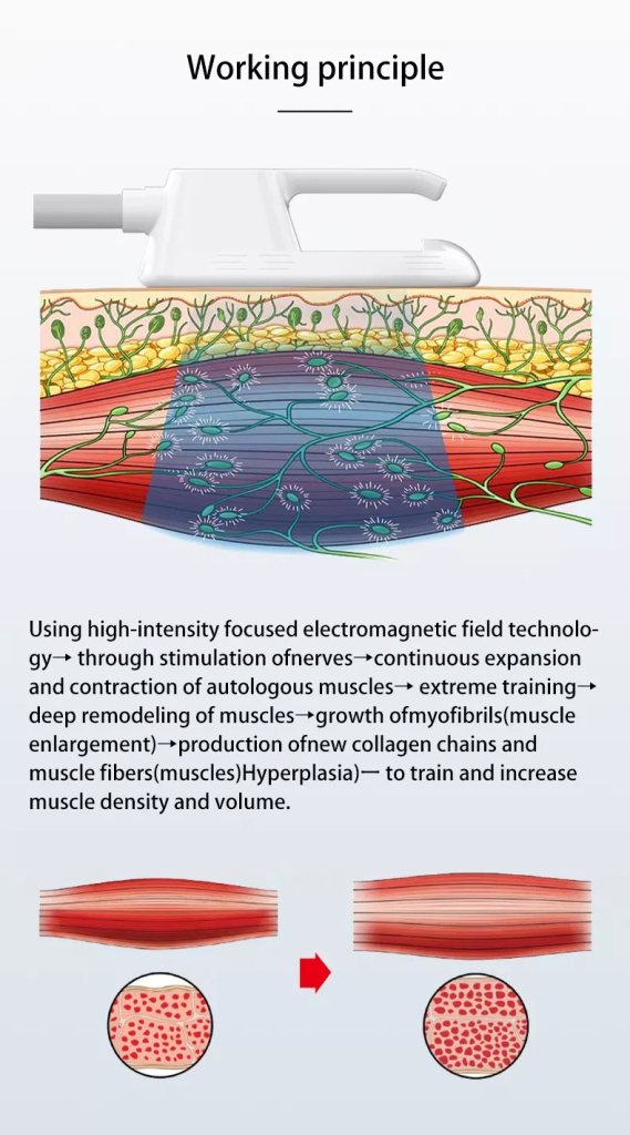 homeuse mini emslim neo with rf emslim nova 2 handles electromagnetic radio frequency portable ems sculpt machine